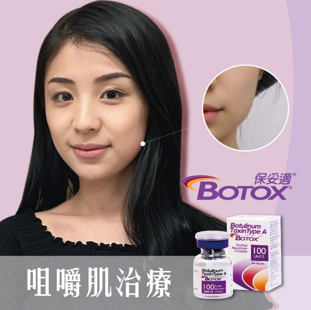 肉毒桿菌 / 保妥適 Botox