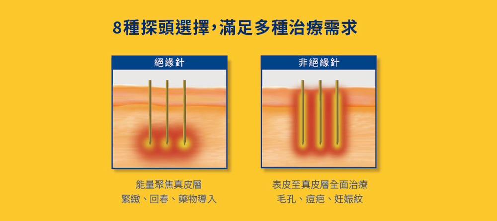 閃電微針 閃電音波-星媺診所